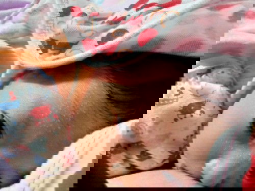 แม่ๆมีวิธีรักษาผดผื่นยังไงคะ