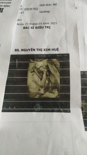 Thai 21w bé gái nặng 370g em 44kg có đủ tiêu chuẩn chưa cac m?