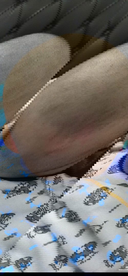 Kepala bayi merah kayak habis jatuh