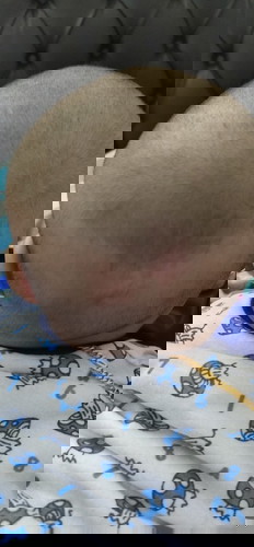 Kepala bayi merah kayak habis jatuh