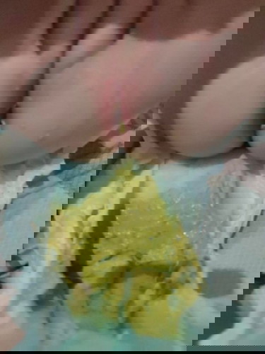 Baby's Diarrhea