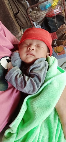 ลูกพึ่งคลอดได้20วันลูกมีเเผลที่ลูกอันฑะน่าจะมาจากอากาศร้อนอับชื้นต้องรักษายังไงคะสงสารลูกมากค่ะ