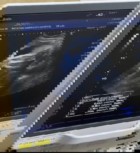 น้ำหนักลูกเยอะไปไหม