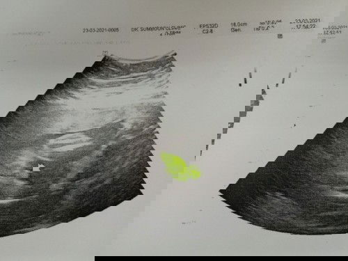 แบบนี้ชัวร์ไหมค่ะ