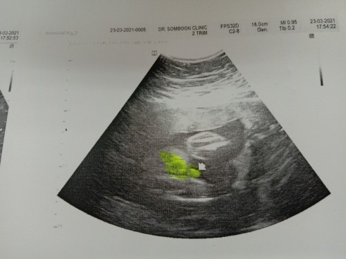 แบบนี้ชัวร์ไหมค่ะ