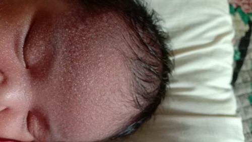 Salam ibu2 bntik2 bnyak mcam ni apa ye?..rsau Pula sya