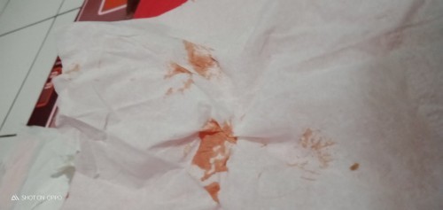 Apakah bahaya keluar darah saat timester pertama