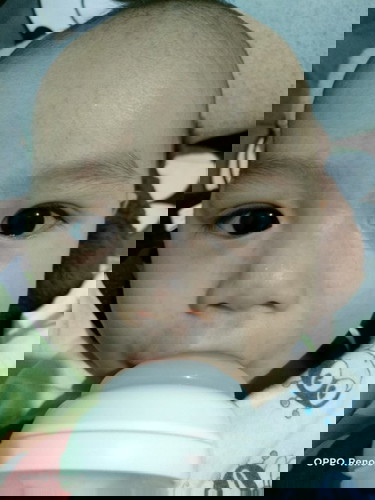 ผื่นขึ้นหน้าน้องเเบบนี้เพราะอากาศร้อนหรือว่าน้องเเพ้อะไรหรือป่าวคะ