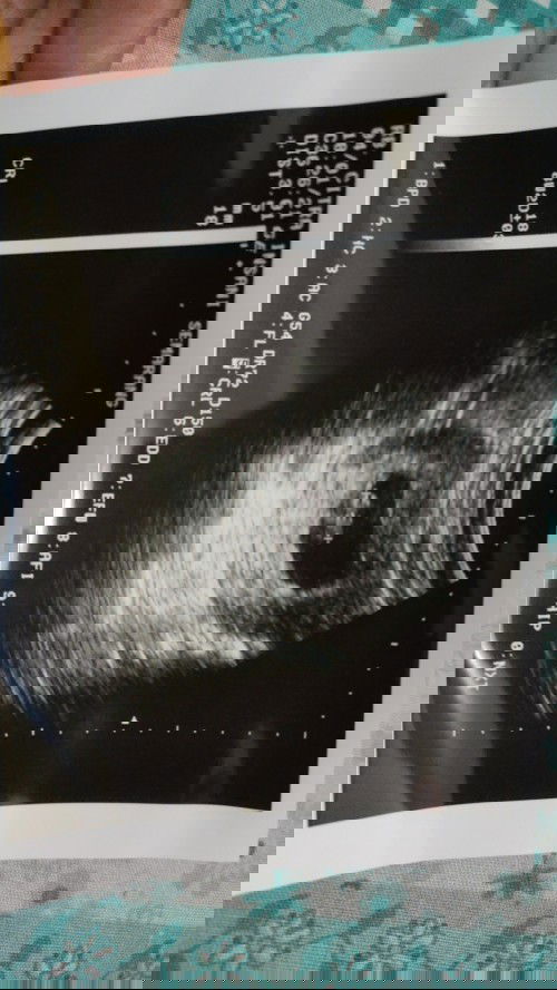 Pertama kali Ngidam di pagi hari, suami bikin emosi!!! Kok bisa???