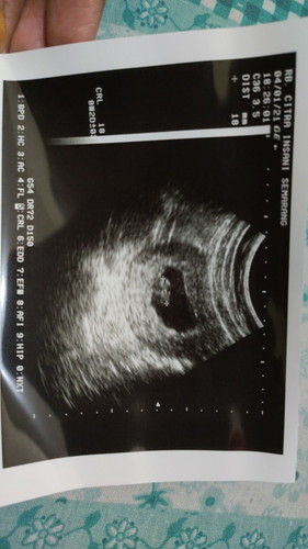 Pertama kali Ngidam di pagi hari, suami bikin emosi!!! Kok bisa???