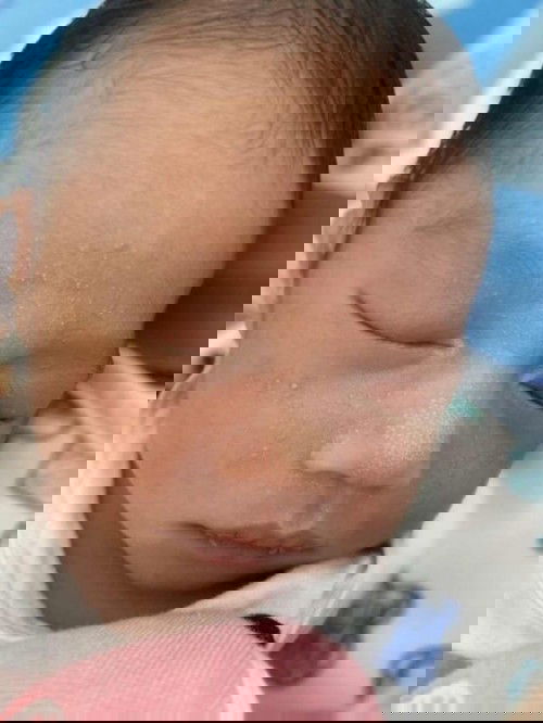 ลูกเป็นผื่นที่หน้าทำยังไงดีคะ