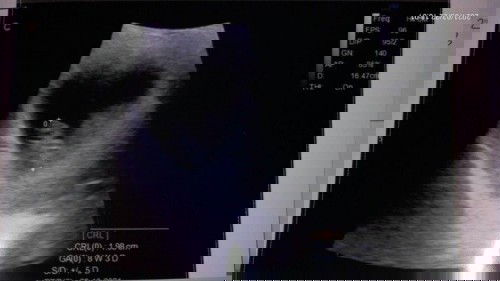 Hamil muda tapi ingin bepergian jauh