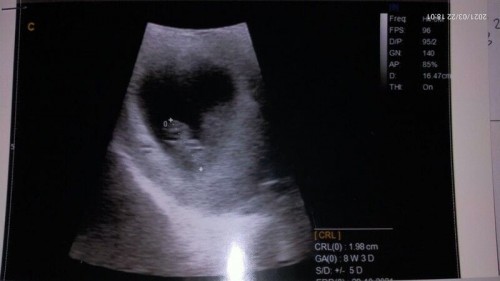 Hamil muda tapi ingin bepergian jauh