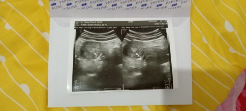 Menurut bunda gambar di bawah menunjukan berapa minguu