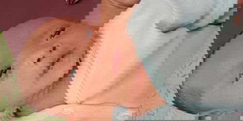 Putih2 pada kulit bayi