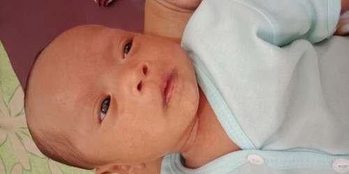 Putih2 pada kulit bayi