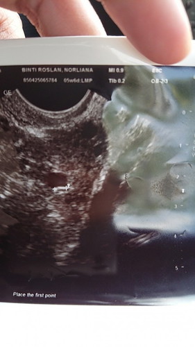 gambar scan 6 weeks
