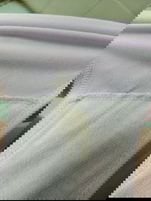 ตกขาวเป็นสีเหลือง