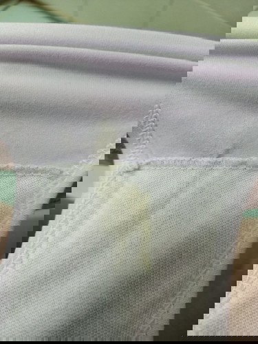 ตกขาวเป็นสีเหลือง