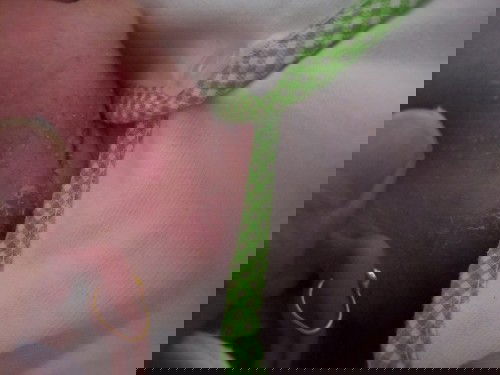 Keringet buntet atau iritasi?