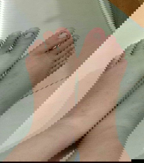 Apakah masih batas wajar kaki bengkak di usia hamil 20 Minggu?