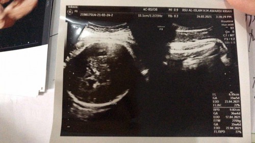 Hasil USG RSI Mawardi