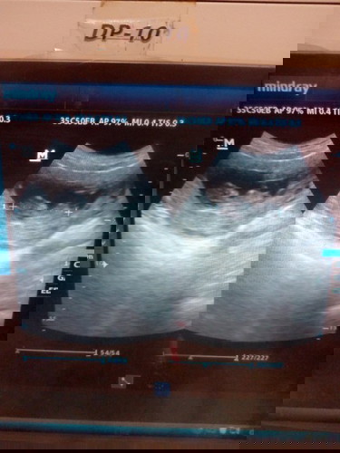 Kira" udah berapa bulan