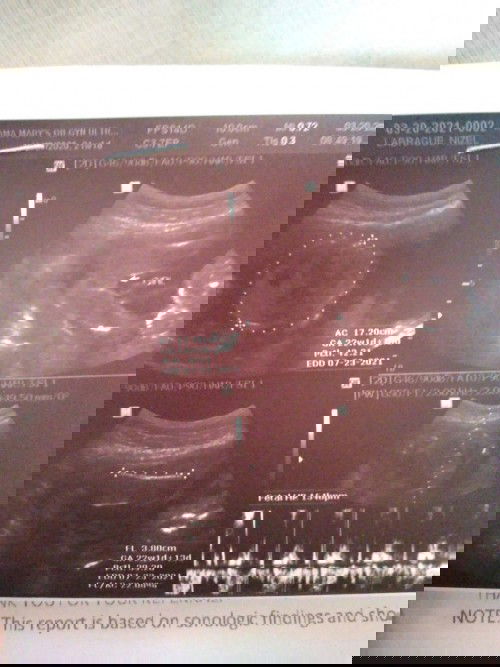 Hey! Mommies I am 23 weeks pregnant ask lang po ako kung pwede na magpahilot na transverse baby ko