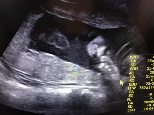 ตั้งชื่อลูกสาว ❤️