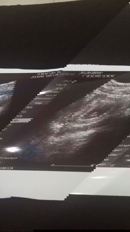 Mantan KET Hamil Lagi