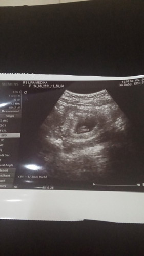 Mantan KET Hamil Lagi