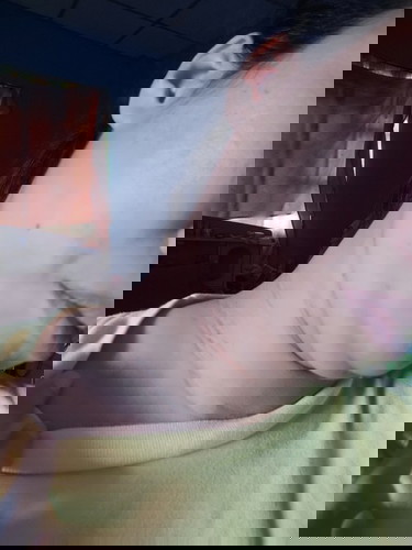 แม่ๆท่านไหนติ่งเนื้อขึ้นตามลำคอบ้างค่ะช่วงท้อง