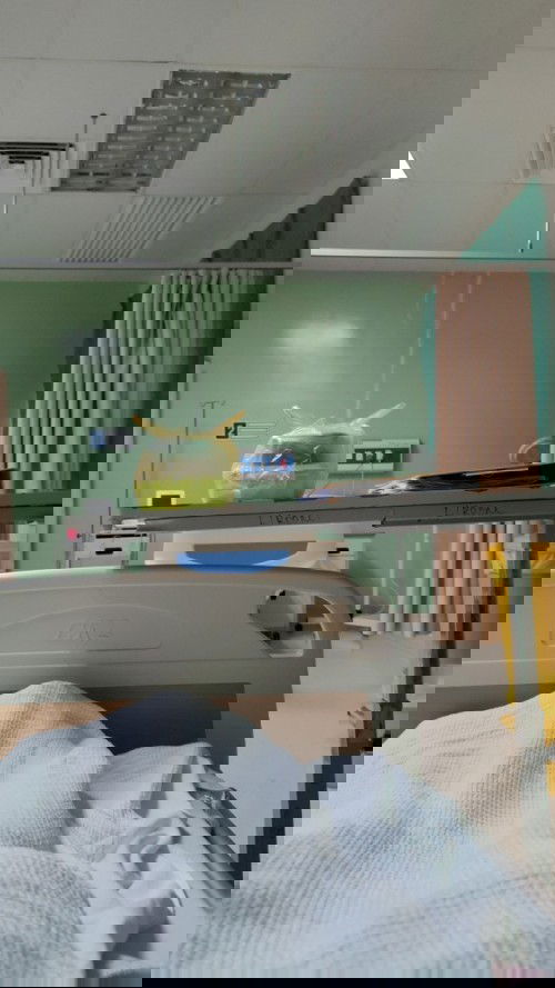 Bleeding 30weeks twins mcda