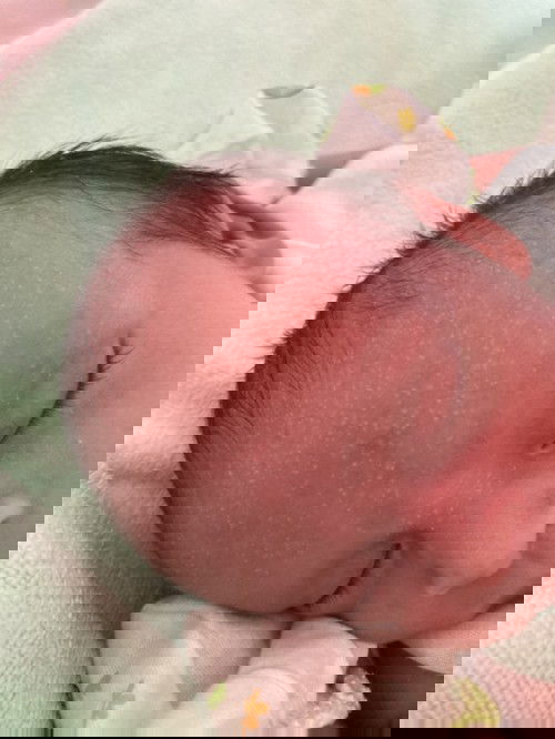 ช่วยบอกทีนี่คือตุ่มขาวอะไร ?