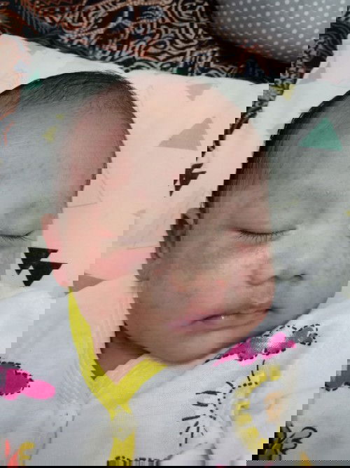 Wajah merah dan merintis