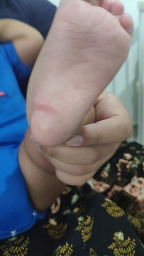 Tapak Kaki Anak ada jalur merah