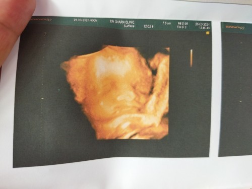 ลูกสาวสมใจอิเเม่