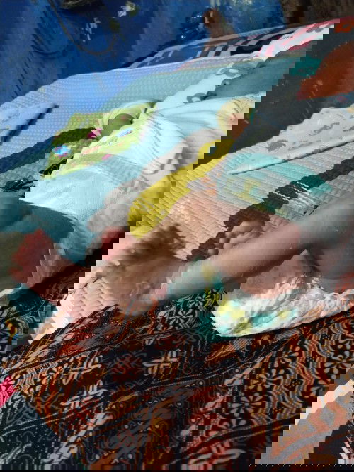 Obat ruam yang ampuh