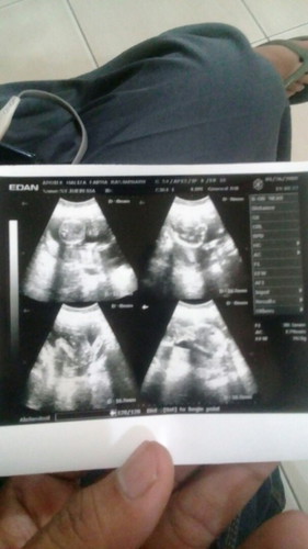 Usia bayi dan hari kelahiran