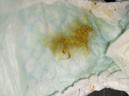 Poop ni baby 2weeks old