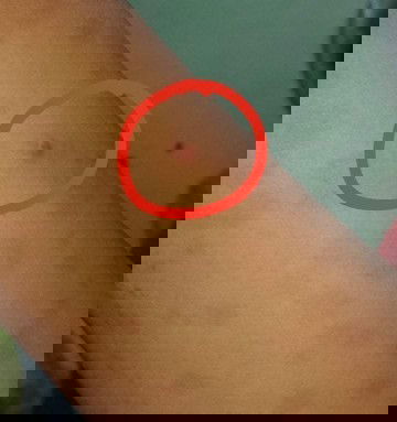 Tigyawat o pigsa ???