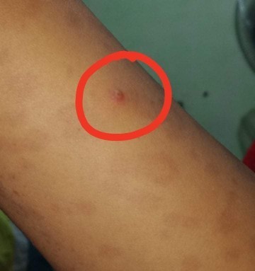 Tigyawat o pigsa ???