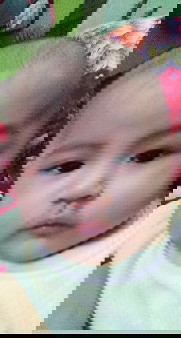 Mata merah pada bayi usia 3 bulan