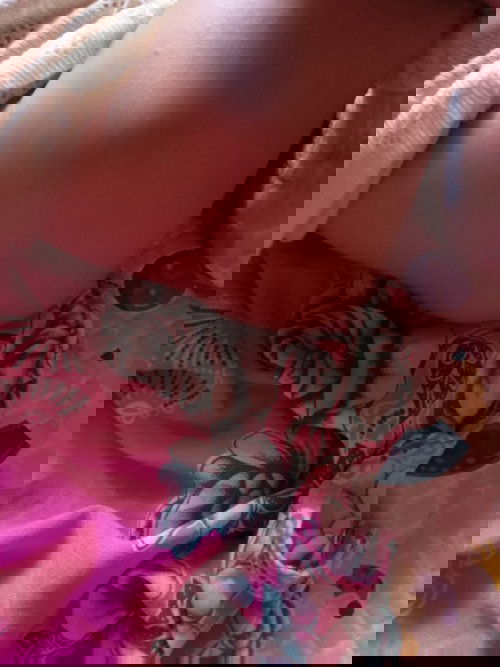 Bekas suntikan imunisasi jadi bengkak