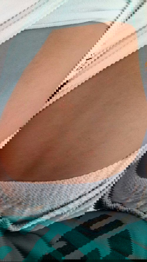 Ruam merah di wajah dan badan