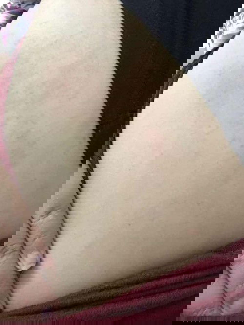 แม่ๆ อายุครรภ์เท่าไหร่กันบ้างแล้วคะ บ้านนี้ 19+4 ค่ะ เป็นผื่นคันตามตัวด้วยบ้านไหนเป็นบ้างคะ