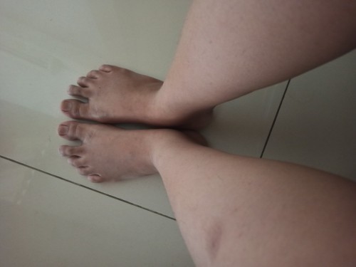 Adakah para bunda yg mengalamai Kaki bengkak ketika hamil tua atau trimester 3??