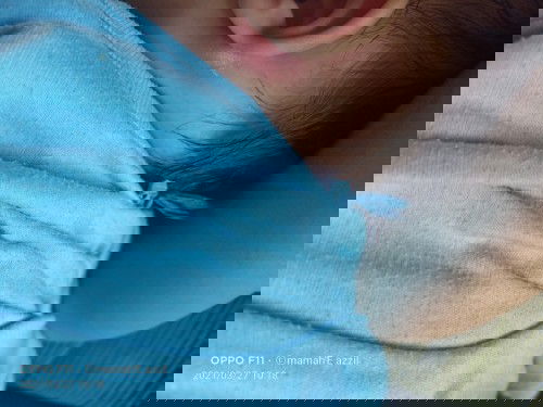 Benjolan belakang daun telinga