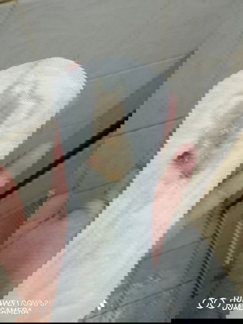 แบบนี้ปกติไหมค่ะ