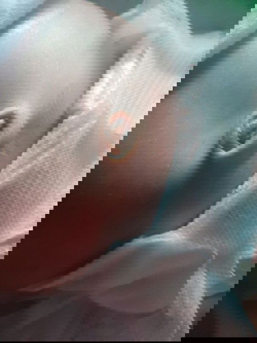 Pusod ni baby after matanggal ang cord